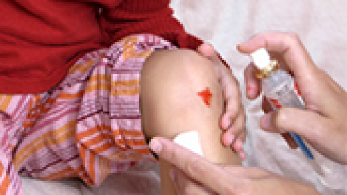 thumbnail of category Ärztliche Wundtherapie
